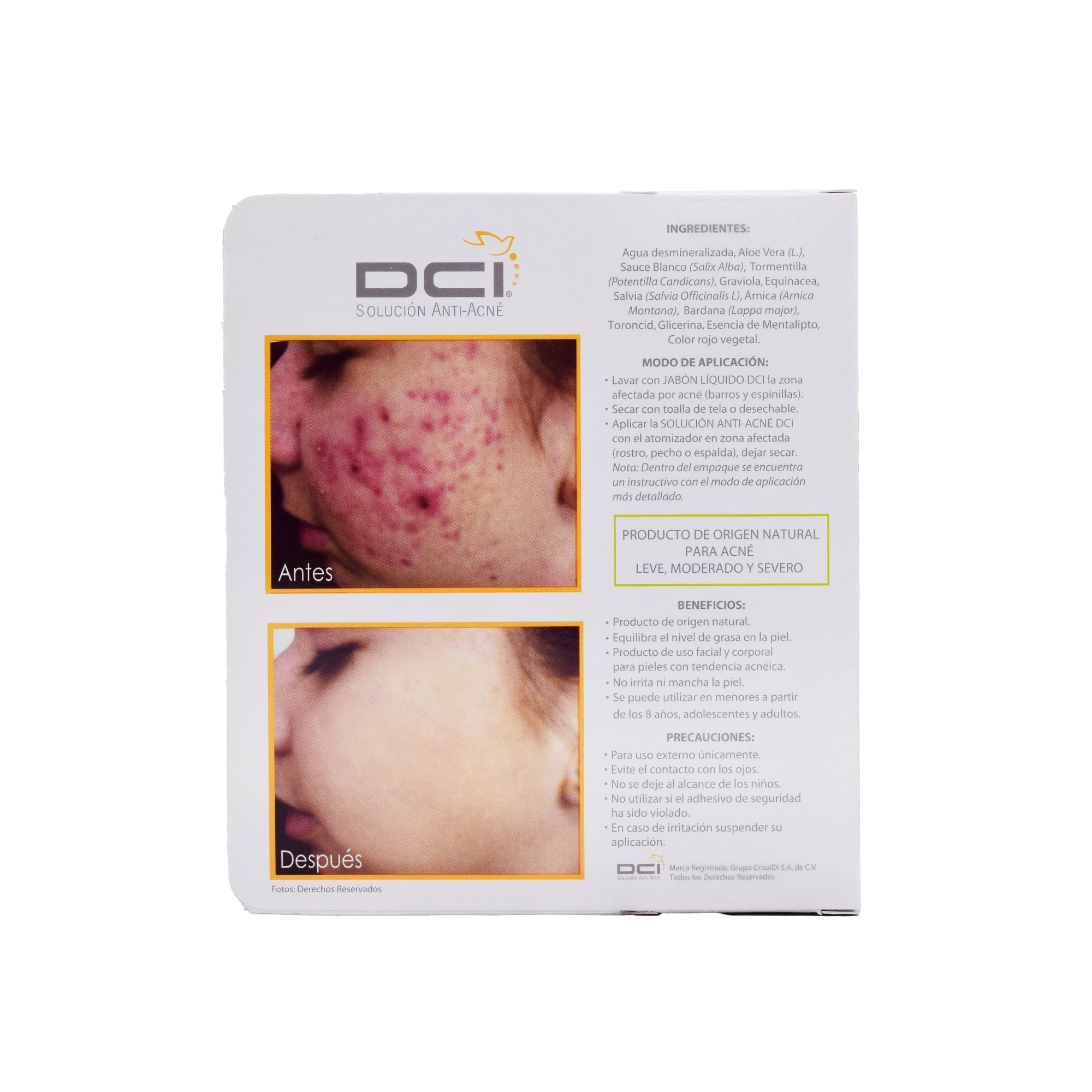 Solucion Antiacne 35 Ml